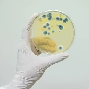 CULTIVO DE HONGOS DE ORINA