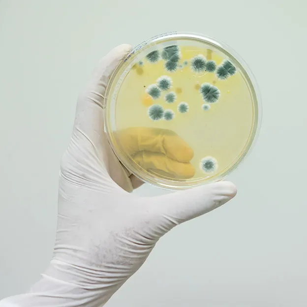 CULTIVO DE HONGOS DE ORINA