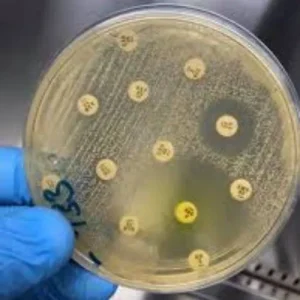 CULTIVO DE SECRECION