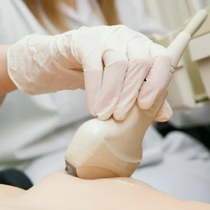 ELASTOGRAFIA DE MAMA