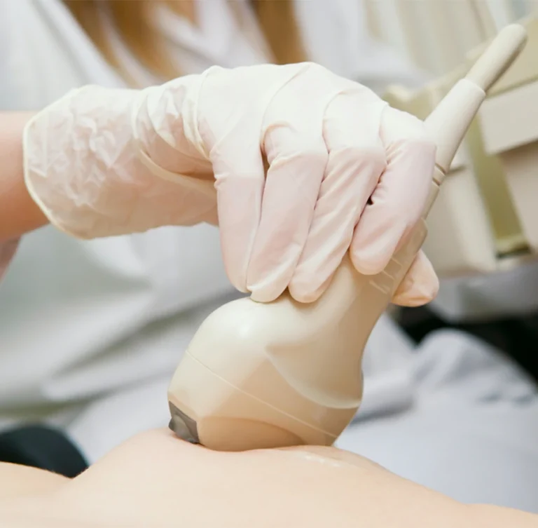 ELASTOGRAFIA DE MAMA