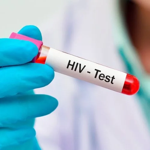 HIV