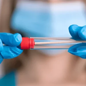 PAPILOMA VIRUS POR PCR CUALITATIVA