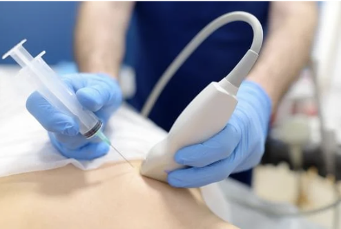 PAQUETE BIOPSIA DE MAMA