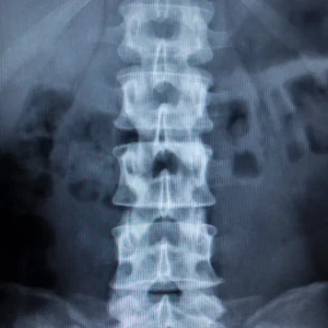 RX COLUMNA LUMBAR