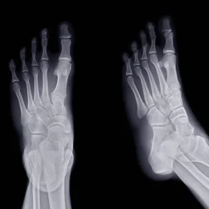 RX PIES COMPARATIVOS UNA PROYECCION