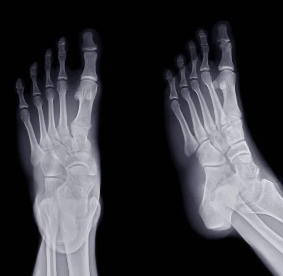 RX PIES COMPARATIVOS UNA PROYECCION