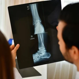 RX TOBILLO DOS PROYECCIONES