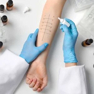 PERFIL ALERGIA ALIMENTARIA