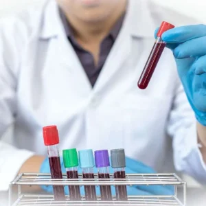 PERFIL DE LIPIDOS SIMPLE