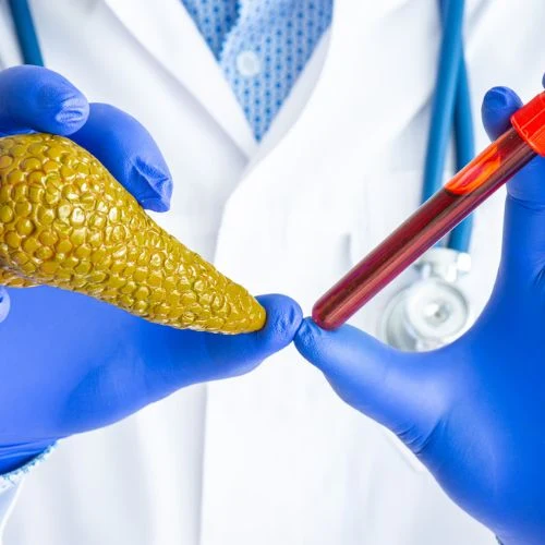 PERFIL DE PANCREATITIS