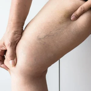 PERFIL DE TROMBOFILIA COMPLETO