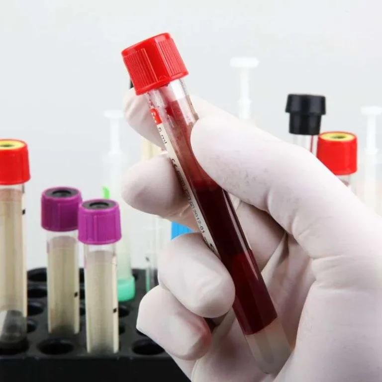 PERFIL TIROIDEO IN VITRO