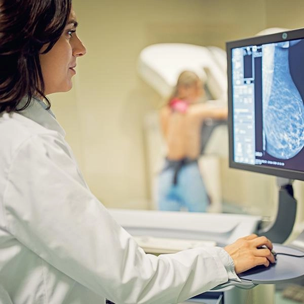 Estudios mastografia