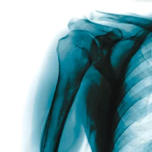 Categorias imagenes Densitometria